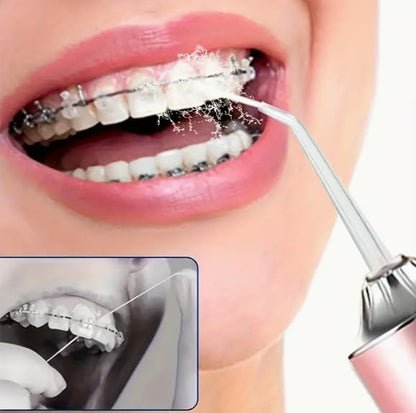 Irigator za usta – savršen saveznik za zdrav osmeh