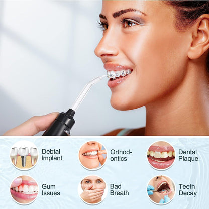 Irigator za usta – savršen saveznik za zdrav osmeh