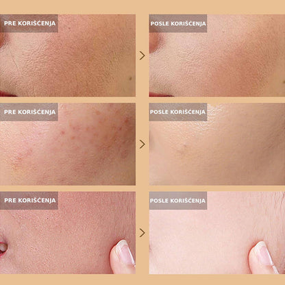 Puževa krema za sjaj i obnovu kože