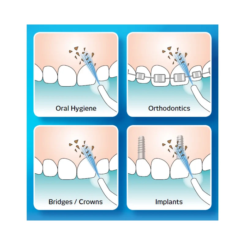 Irigator za usta – savršen saveznik za zdrav osmeh